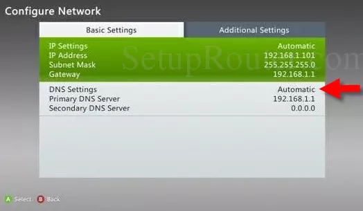 xbox360 dns settings automatic arrow