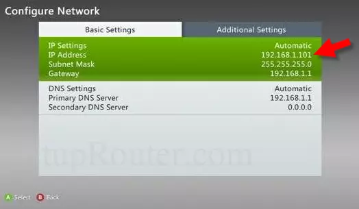 aanvulling kever naast Static IP Address for Xbox 360