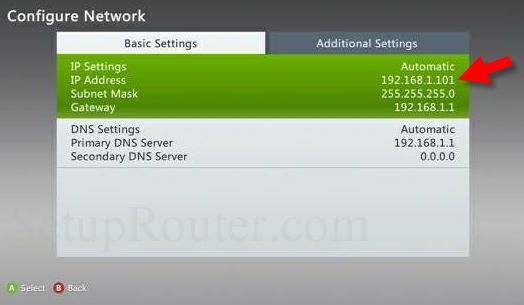 Static Ip Address For Xbox 360